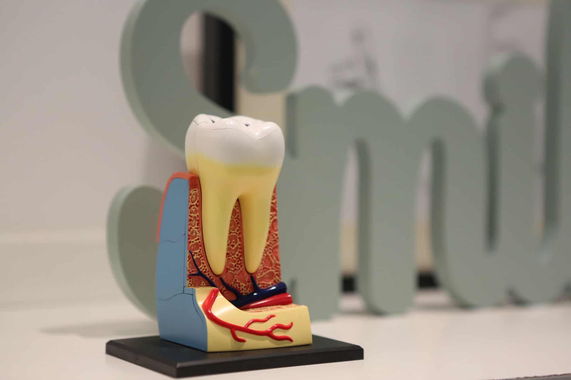 Wurzelspitzenresektion bei AUX-DENT: Präzise chirurgische Zahnerhaltung mit Mikroskop