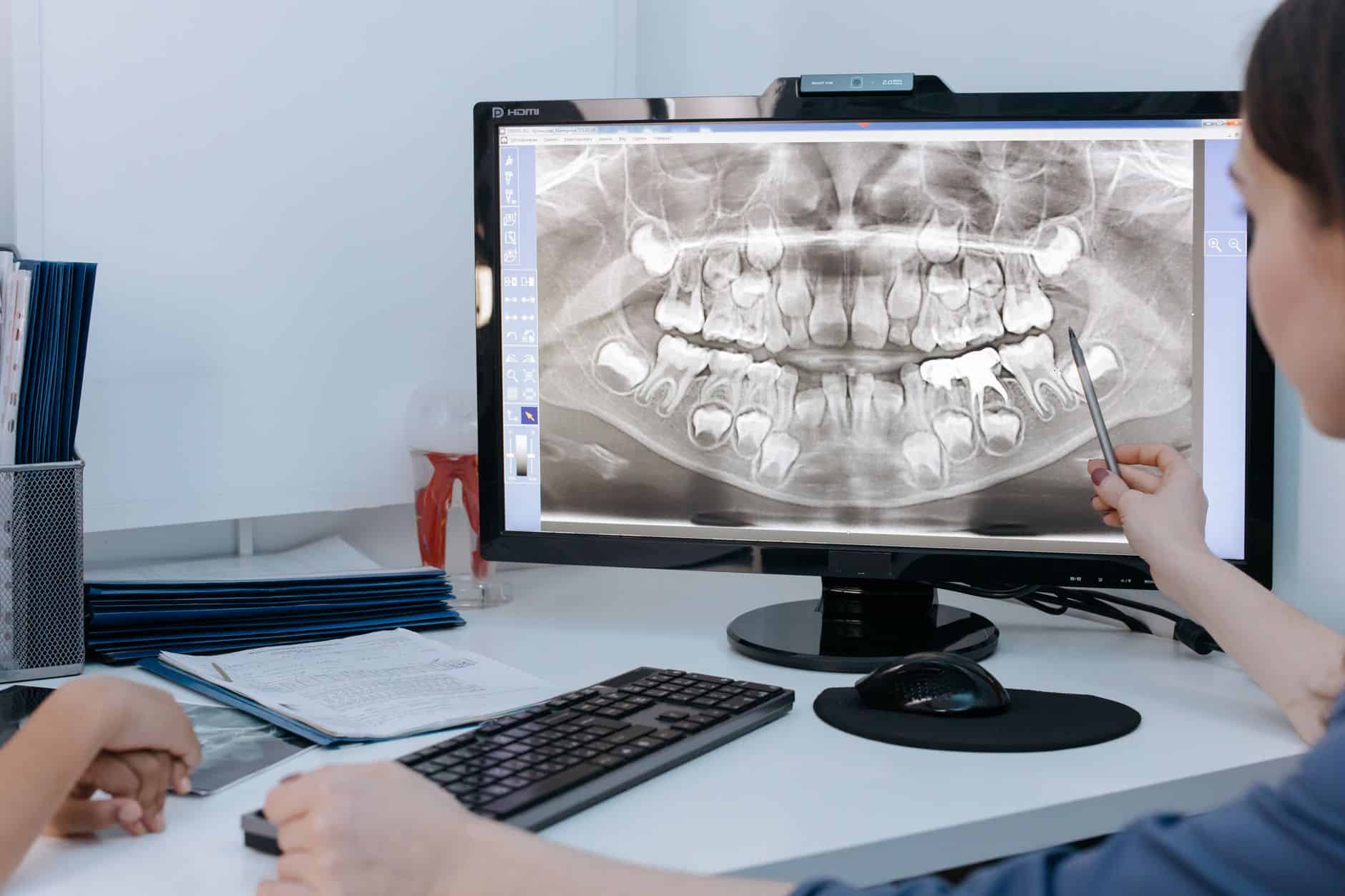 DVT 3D-Röntgen beim Zahnarzt: Präzise Diagnostik bei AUX-DENT Augsburg