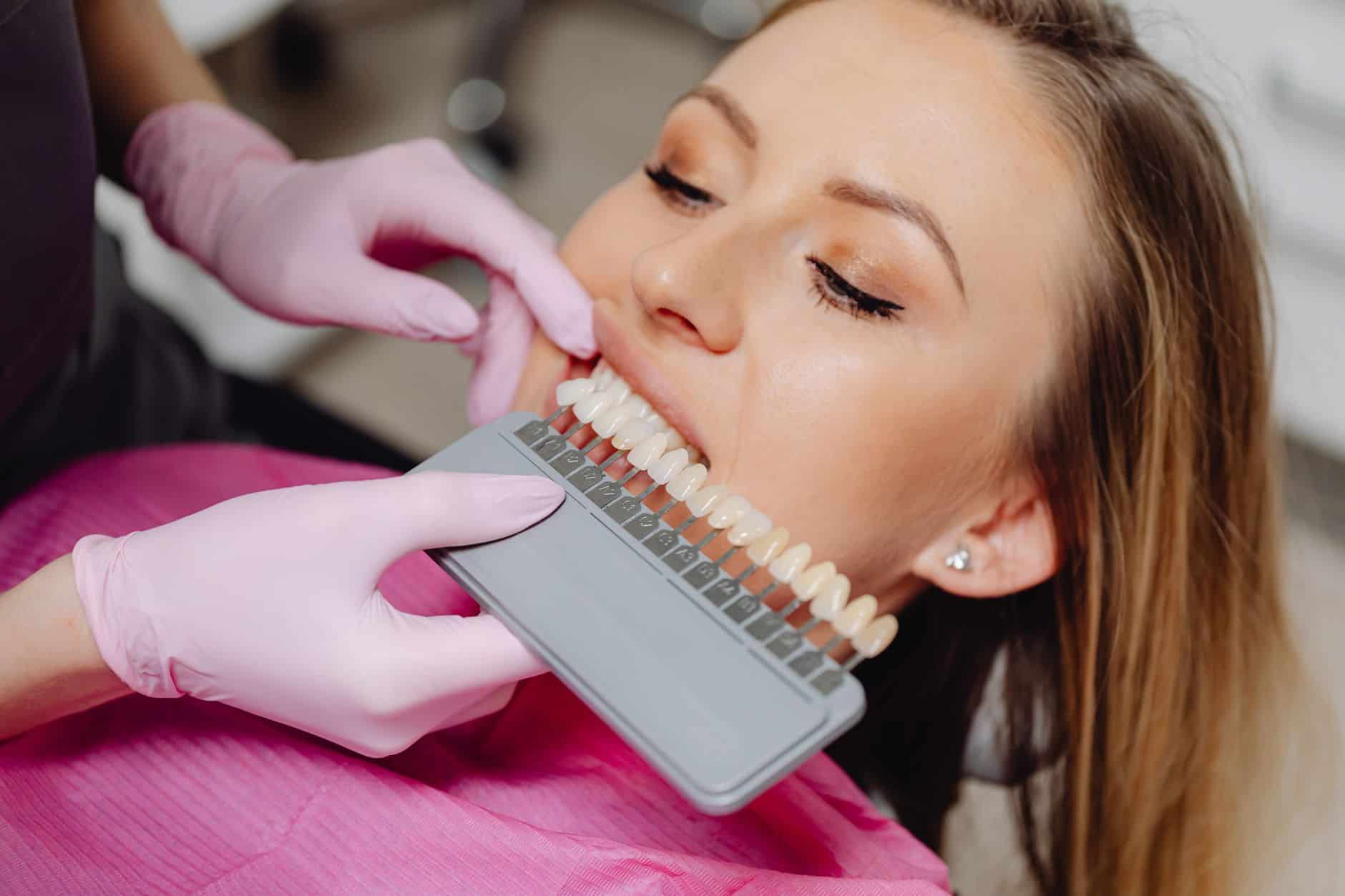 Professionelles Bleaching beim Zahnarzt für strahlend weiße Zähne ohne Schäden