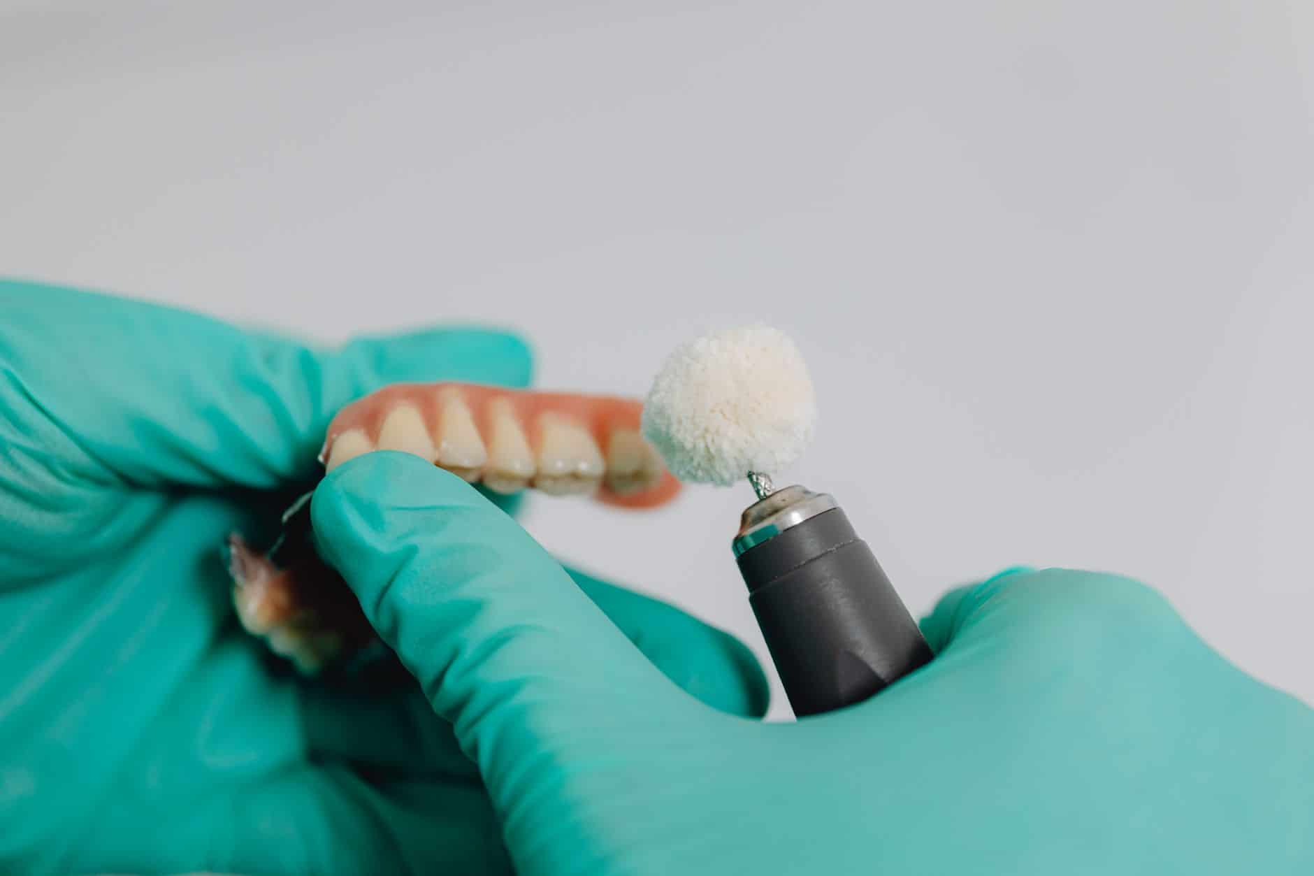 Vergleich verschiedener Zahnersatz-Optionen: Implantat vs. Brücke vs. Prothese