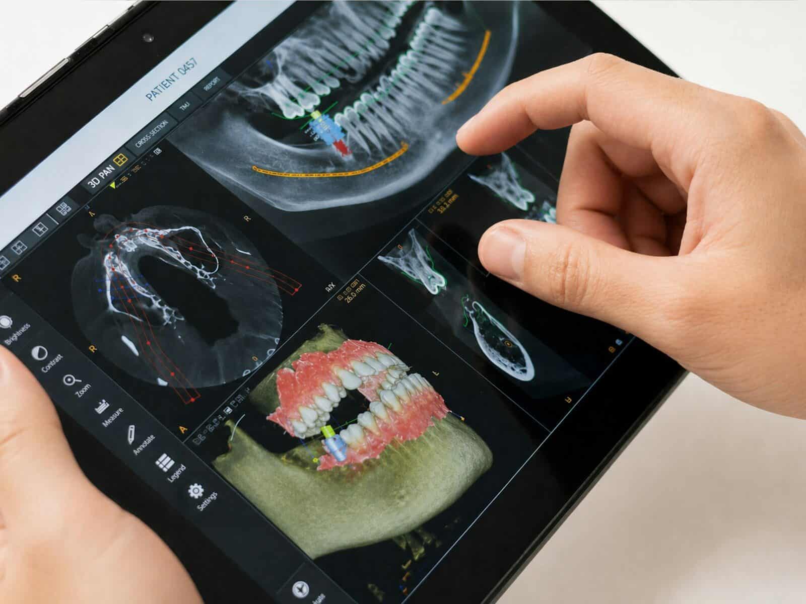 Dentist examining 3D dental scan on tablet